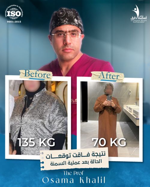 من هم المرشحون لعملية تحويل المسار؟